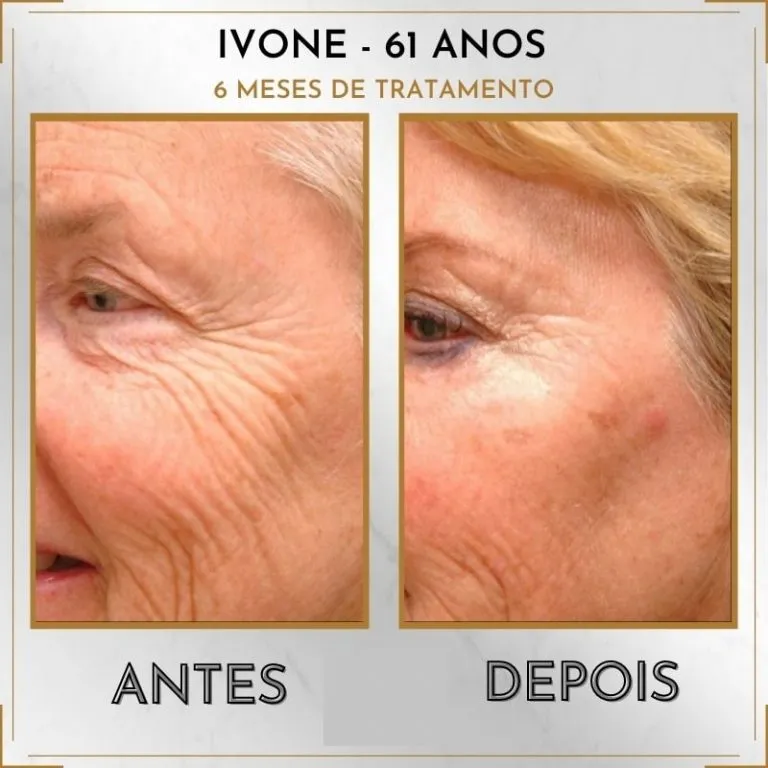 Cliente 1